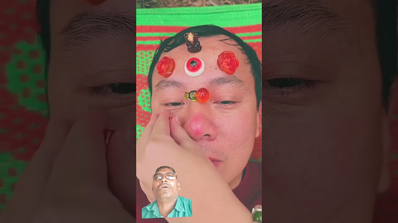 He eats sausages and insects