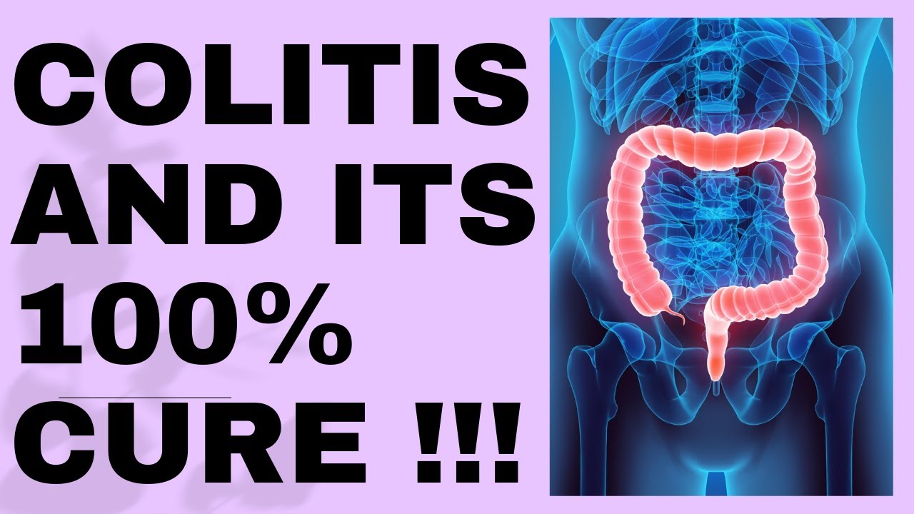 colitis||homeopathy medicine for colitis in hindi||ulcerative colitis homeopathy medicine in hindi !