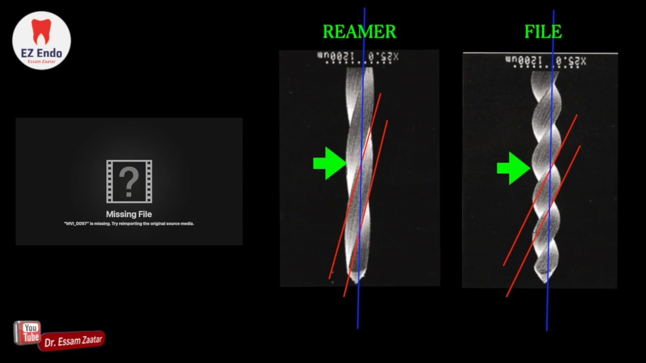 Basics in root canals' scouting اقتراح بالرجوع الي الماضي عند استكشاف قنوات الجذور