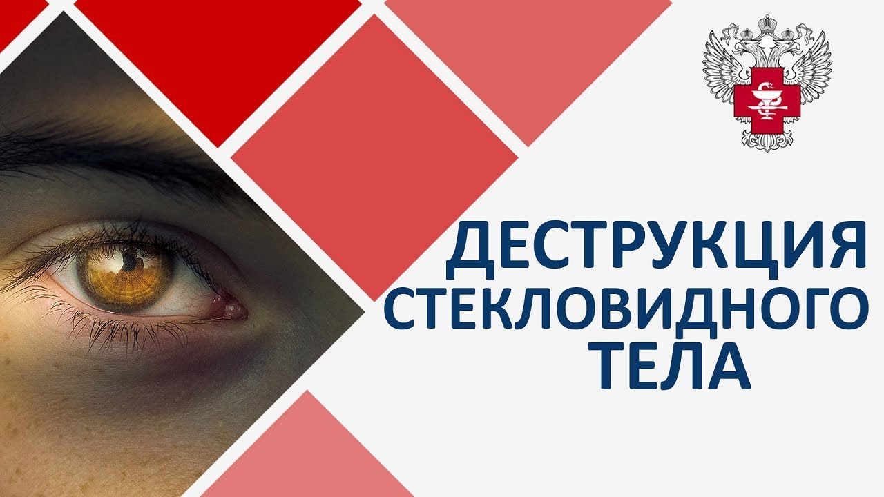 Деструкция стекловидного тела лечение. 👓 Лазерное лечение деструкции стекловидного тела. 12+