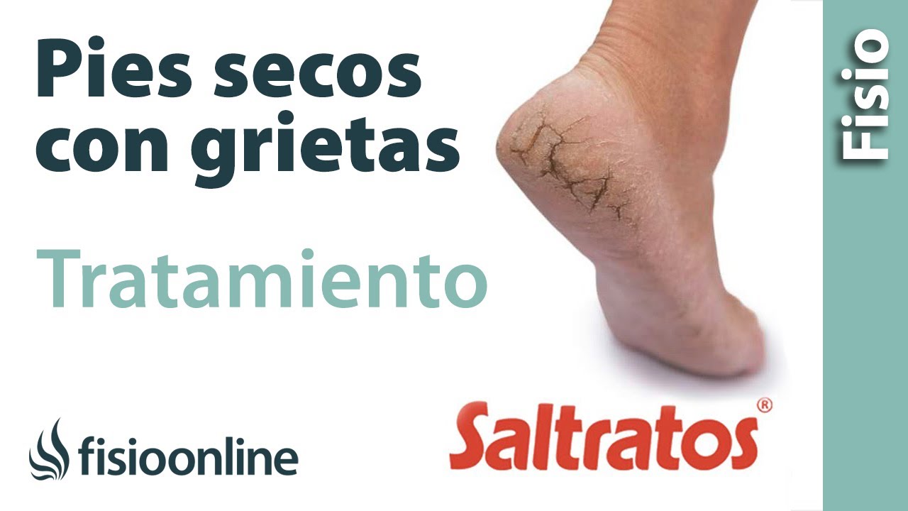 Pies secos y con grietas. Qu&eacute; es, causas, consejos y tratamiento