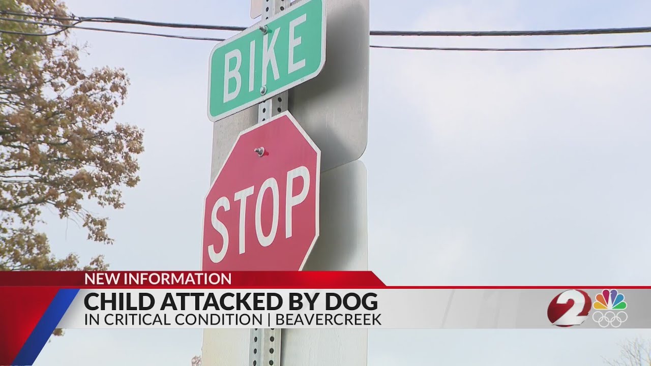 Child attacked by dog in Beavercreek