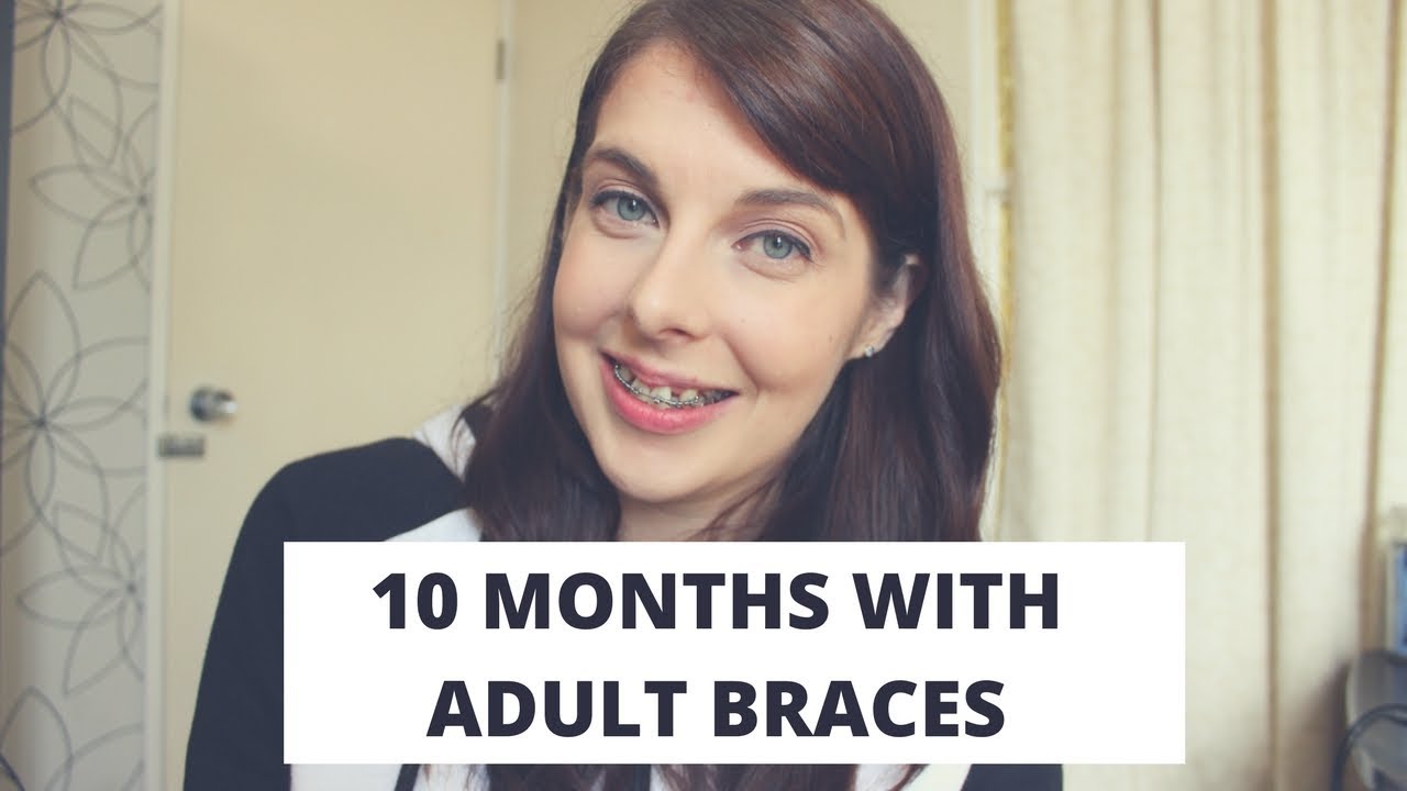 10 Month Adult Braces Progress
