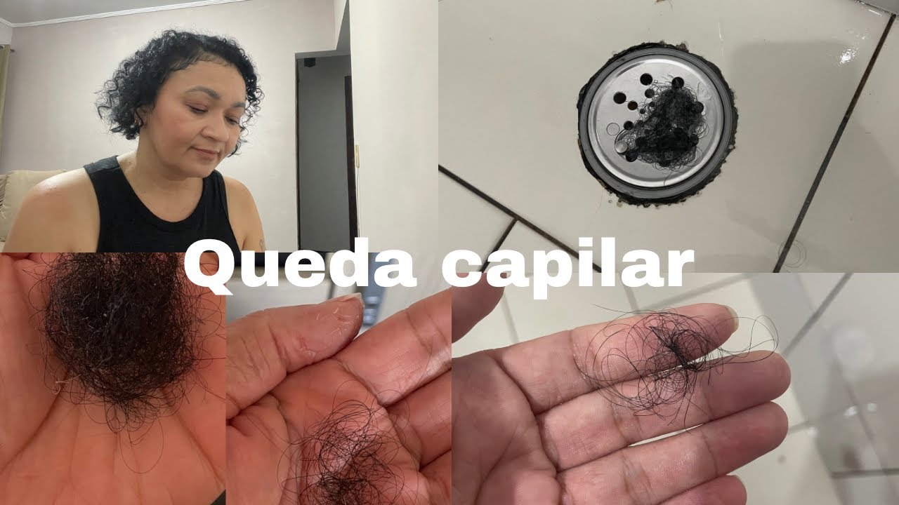 Tudo sobre a minha queda capilar e tratamento!! #cabelo #quedacapilar #cachos
