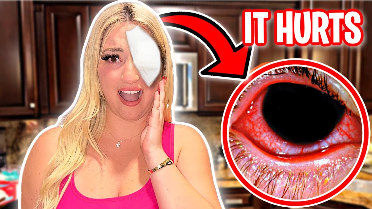 My EYE is INFECTED...