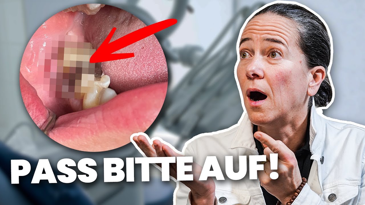 Was ist eine Fistel? Zahnärztin klärt auf