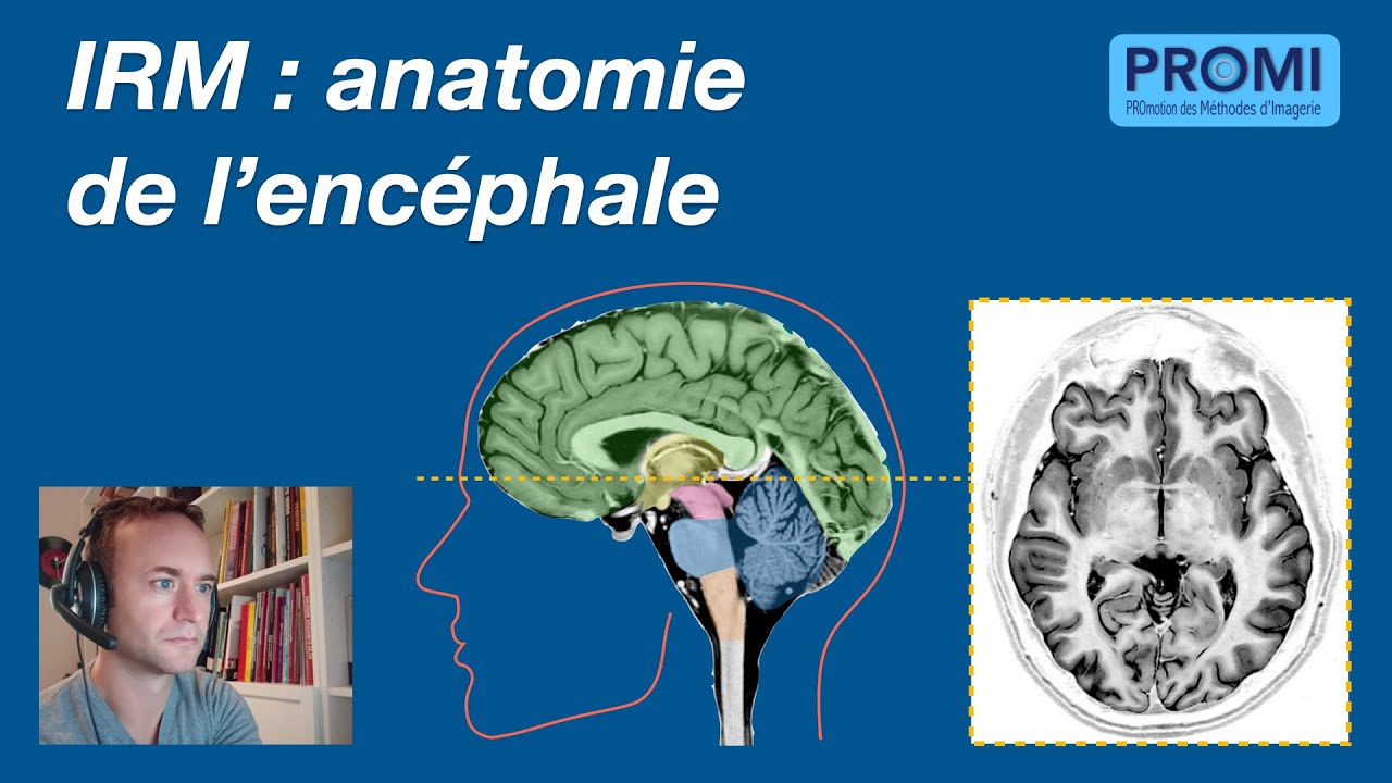 IRM : anatomie de l'encéphale