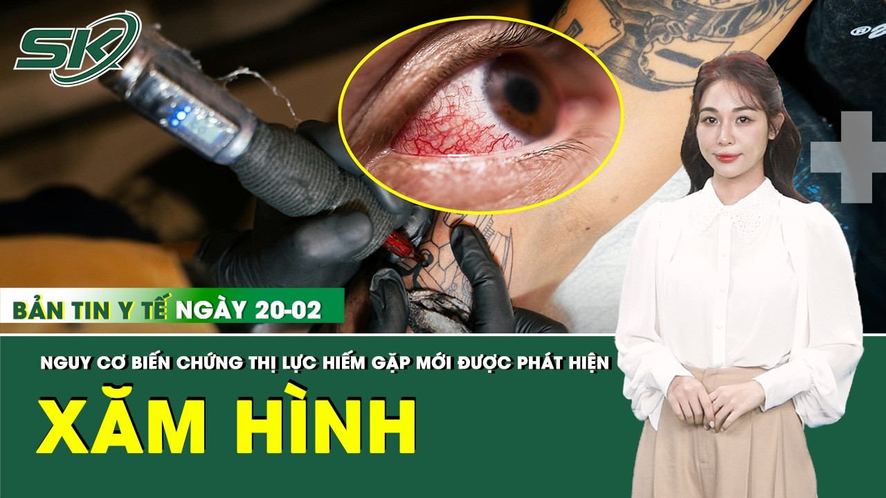 Bản Tin Y Tế 20/2: Hàng chục người mắc biến chứng thị lực hiếm gặp sau xăm hình | SKĐS