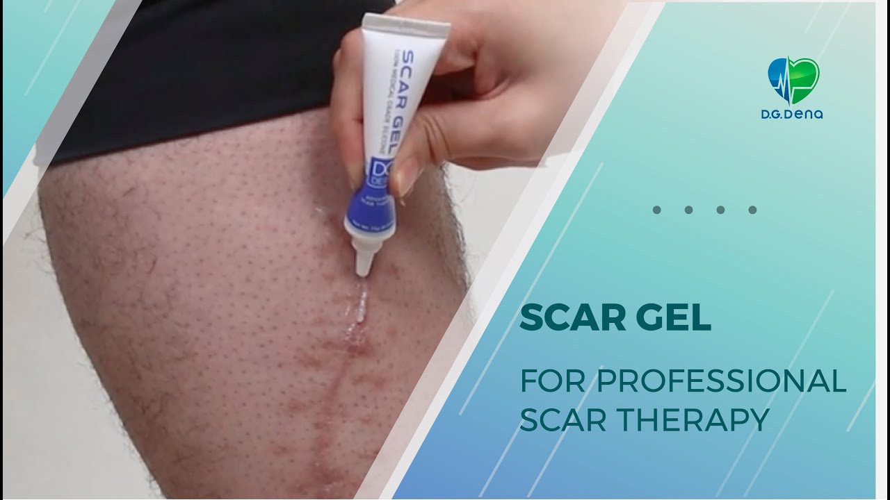 Why Choose D.G. Derm® Scar Gel? | Safe & Effective Silicone-Based Formula