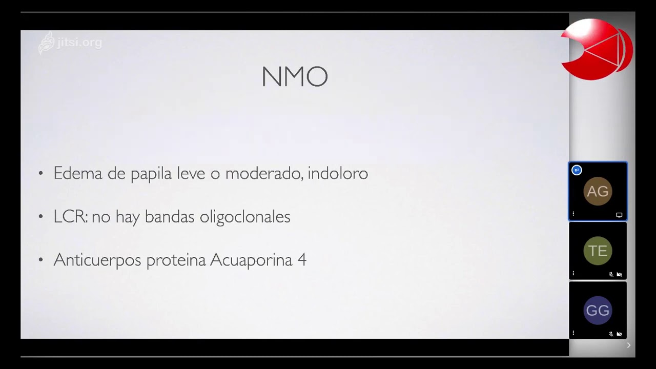 Neuroftalmología: Casos clínicos | Dr. Adolfo Güemes y Dr. Luis E. Abad