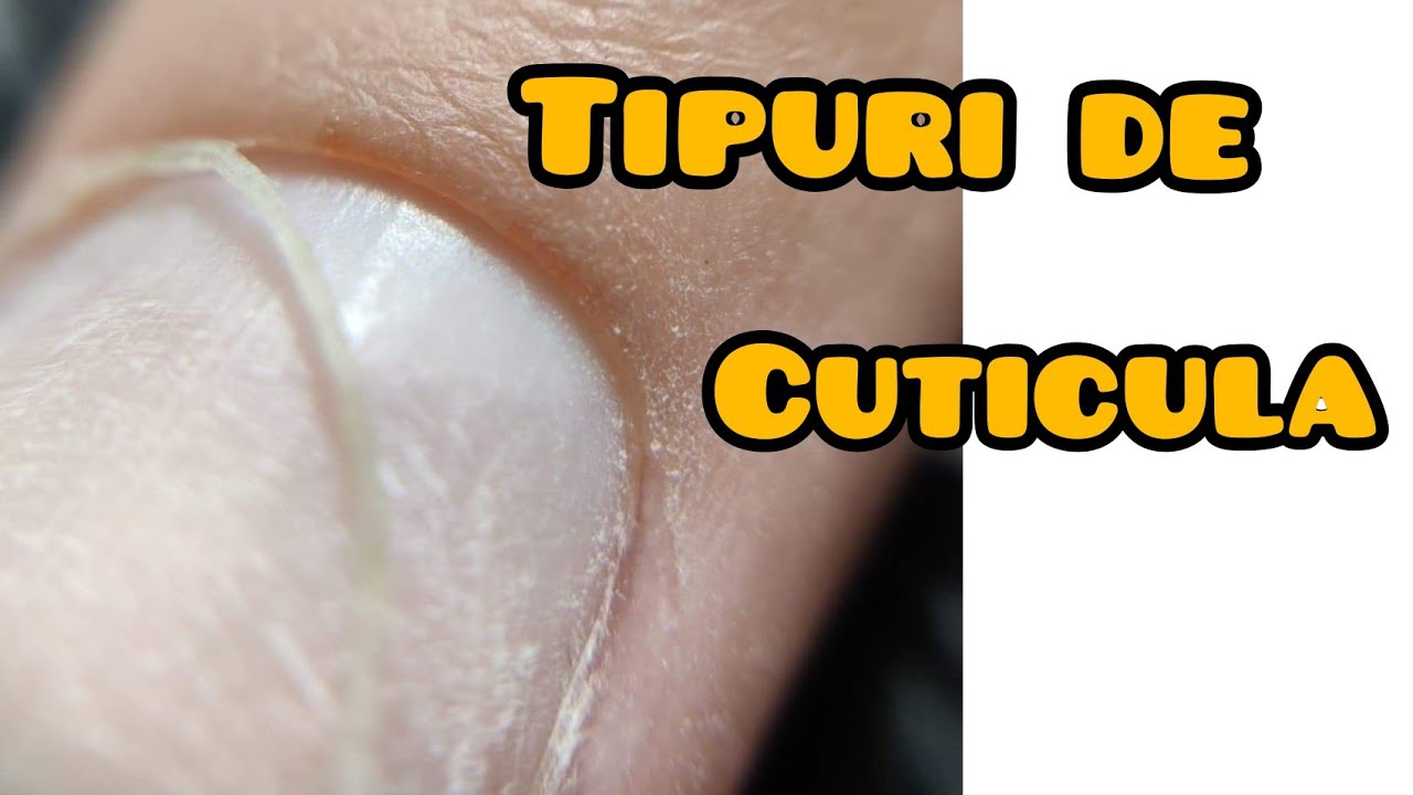 Tipuri de cuticula