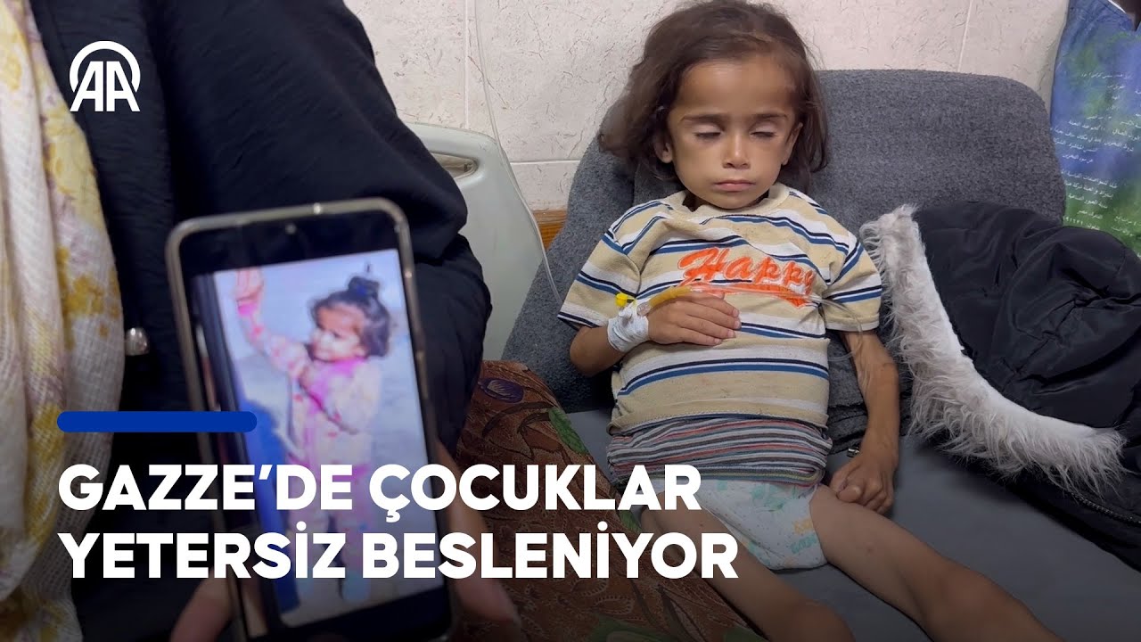 Gazze'de kadın ve çocuklarda yetersiz beslenme vakaları artıyor