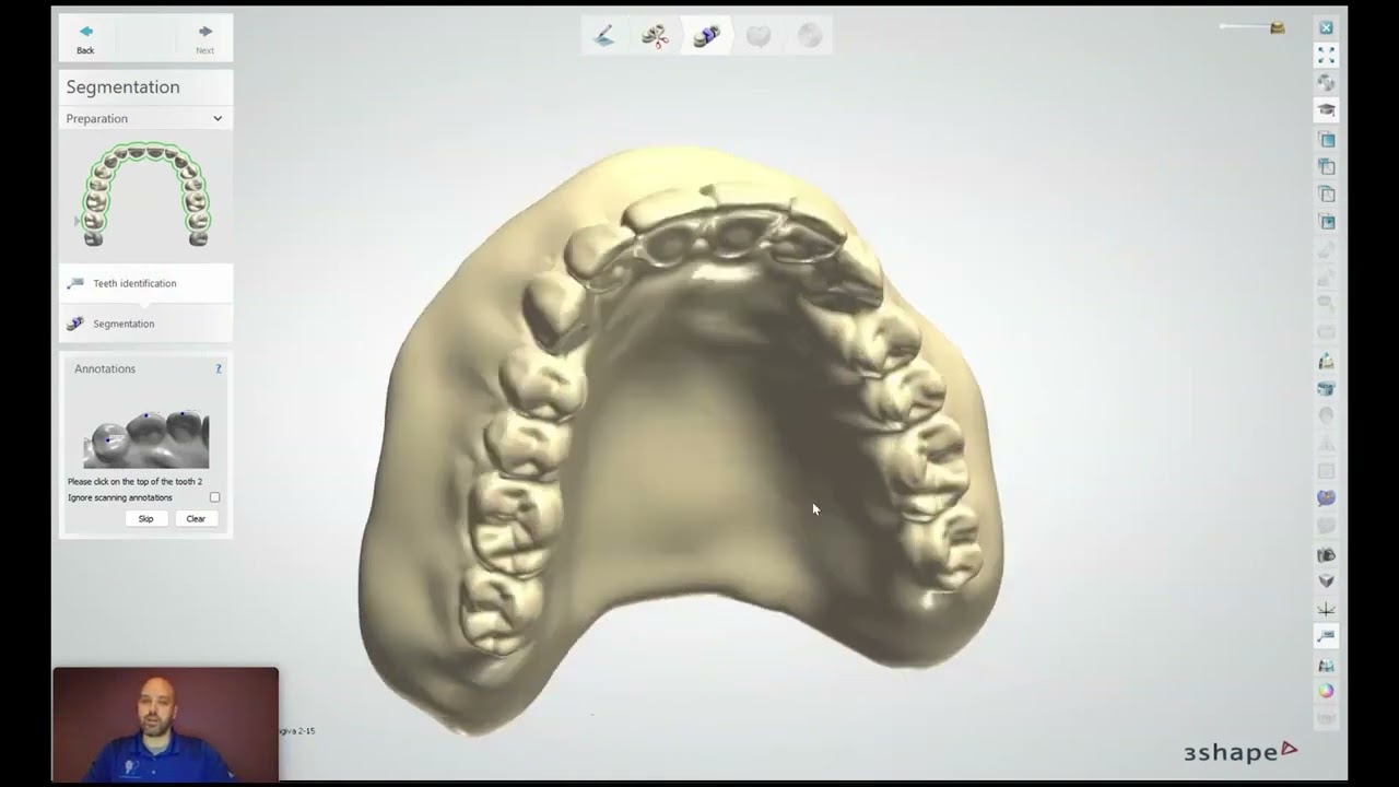 Stratasys Academy | TrueDent용 3Shape 복제 틀니 디자인