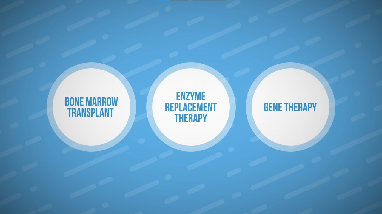 SCID Compass: Exploring Treatment Options