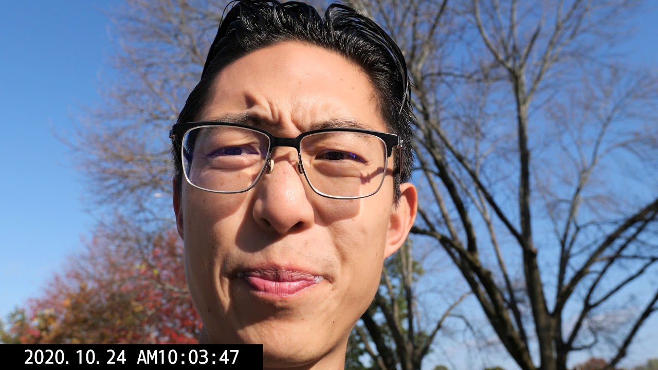 WHY AM I SO SENSITIVE TO LIGHT?