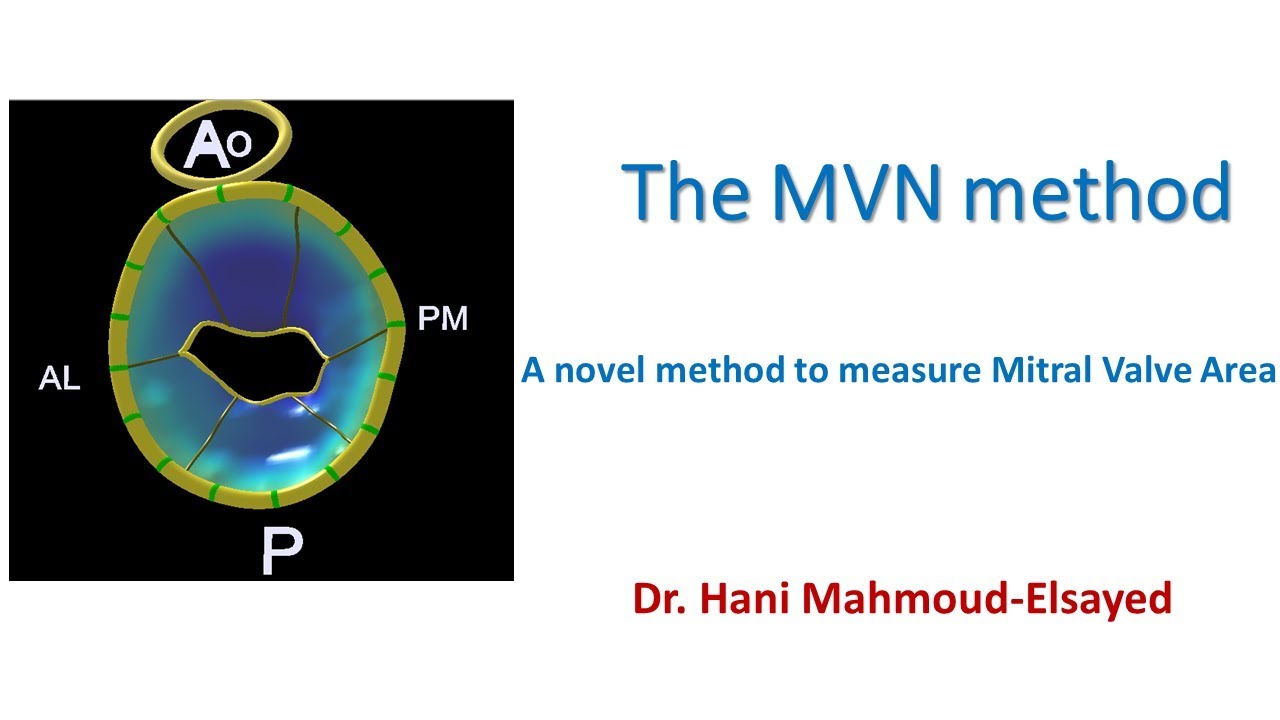 A novel method to measure Mitral Valve Area 