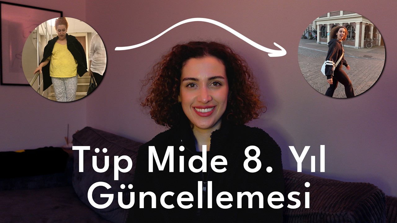 Tüp mide ameliyatından sonra kilolarımı nasıl korudum?