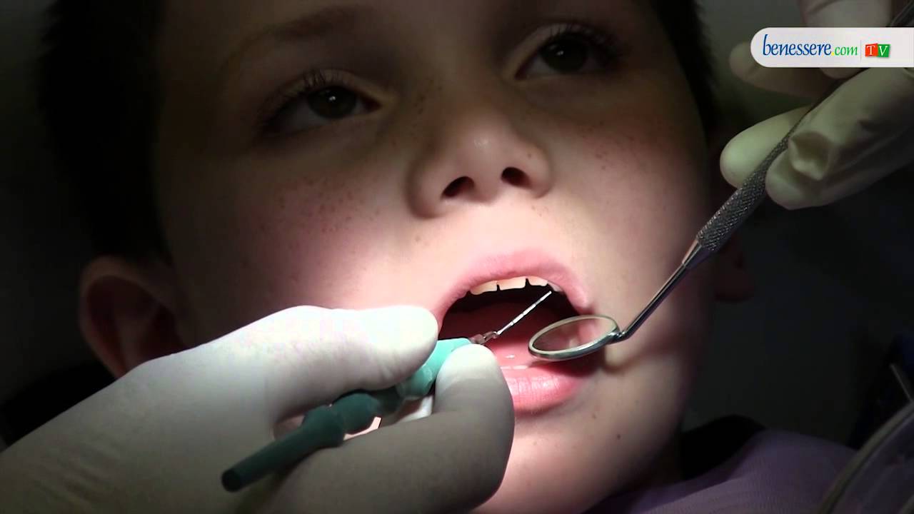 Igiene orale nei bambini: controllo della placca e corretto spazzolamento