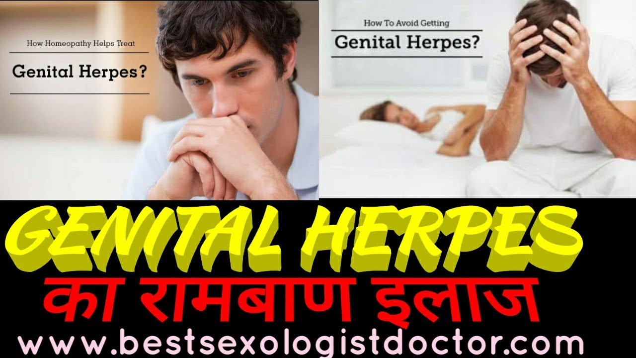 Genital Herpes treatment In Homeopathy|Best Sexologist doctor in bhopal|Homeopathic treatment herpes