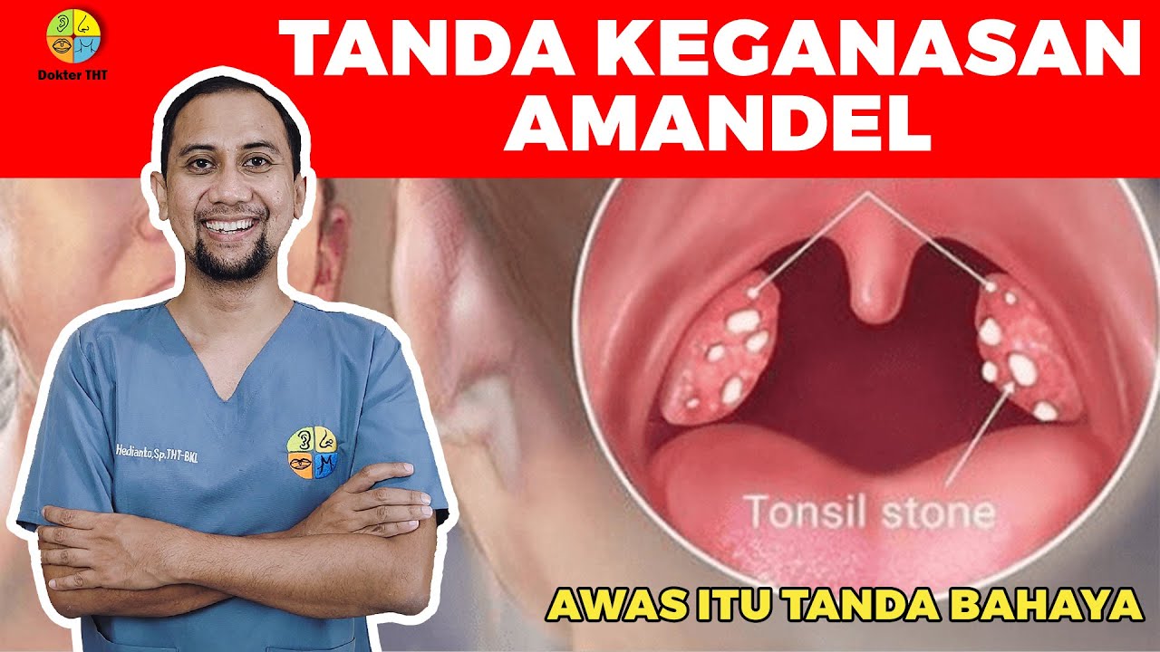 HATI-HATI DENGAN AMANDEL KALAU SUDAH JADI BEGINI