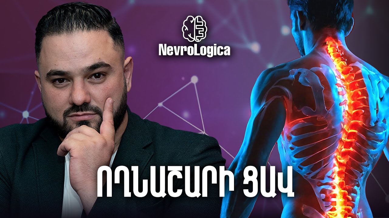 Ողնաշարի ցավ․ Ու՞մ դիմել, ի՞նչ անել | NevroLogica 15
