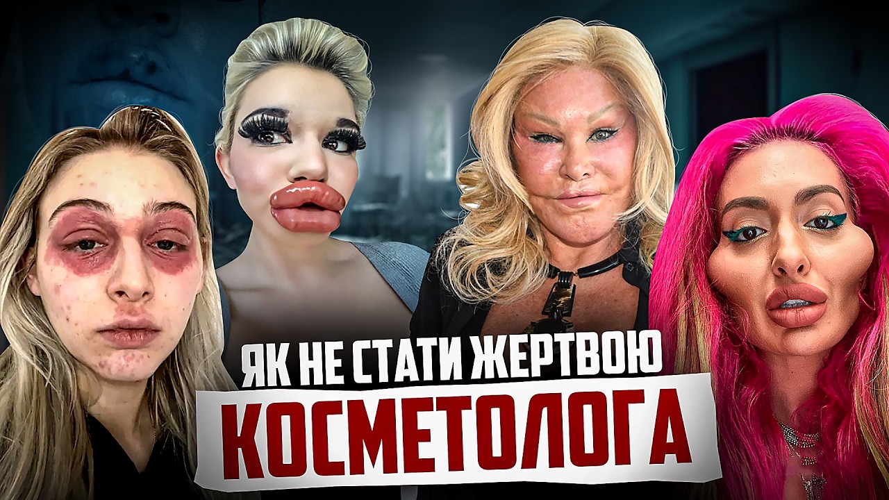 ПРАВДА про ЗБІЛЬШЕННЯ ГУБ, ОЗЕМПІК, ФІЛЕРИ ТА БОТОКС | Котик хоче знати #06