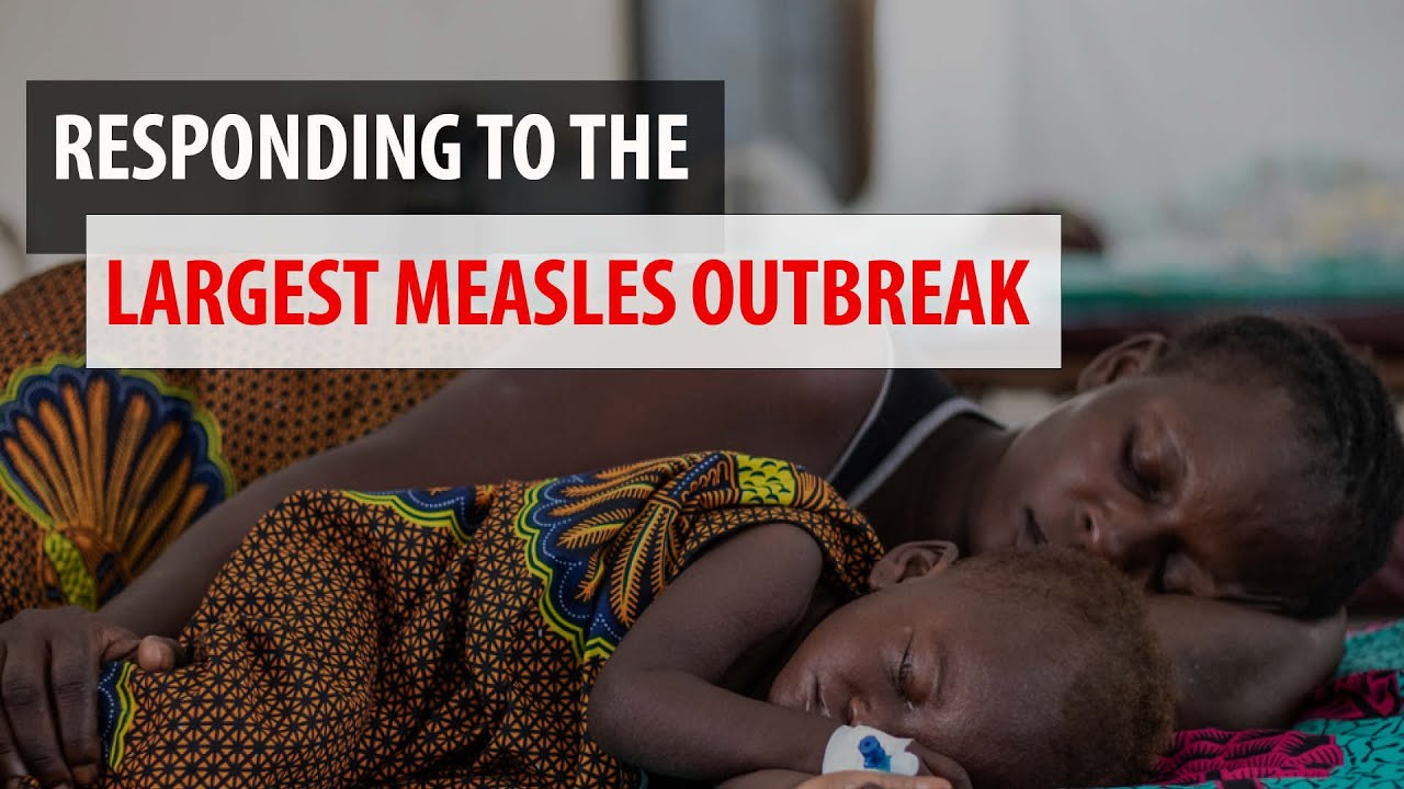 Largest measles outbreak: MSF intervenes in Kongo Central, DRC