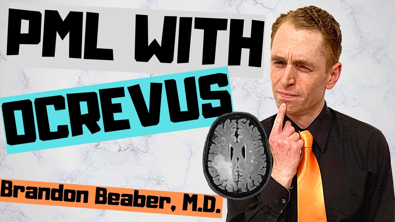 PML in Patient Taking Ocrevus!