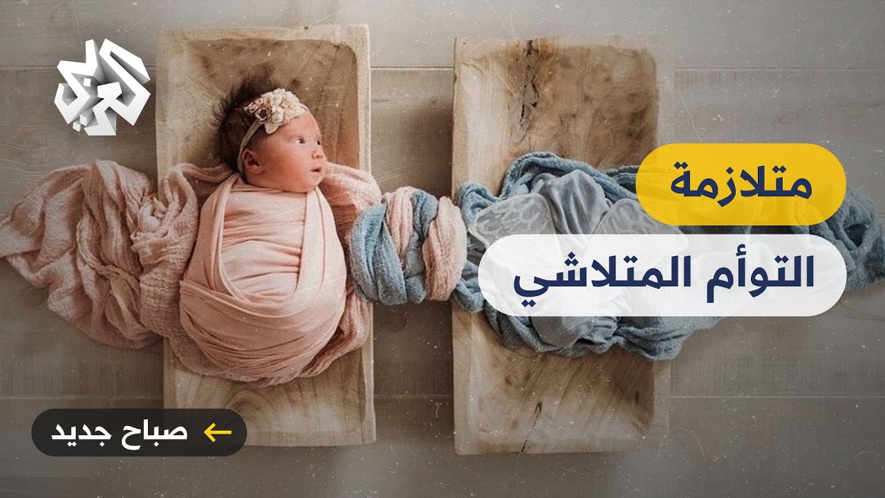 متلازمة التوأم المتلاشي .. لماذا يختفي الجنين من رحم أمه؟