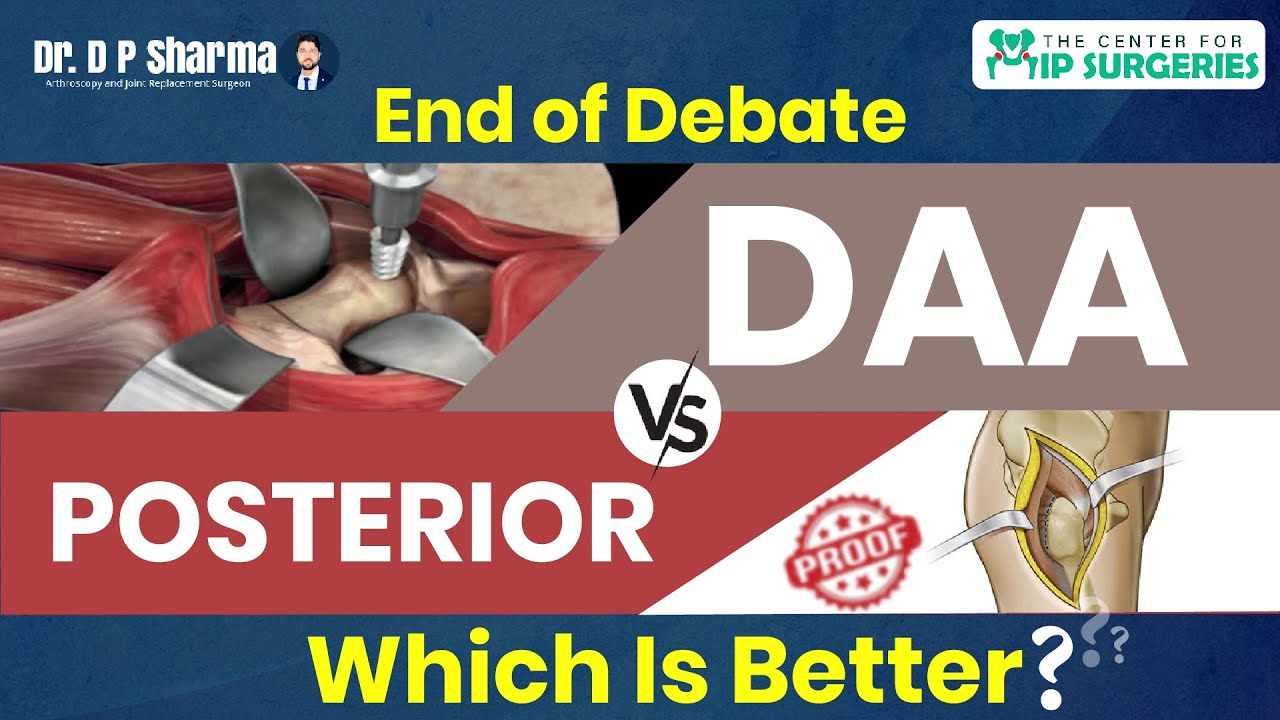 Which THR Technique Is Better? DAA VS POSTERIOR - Hip Replacement Expert in Delhi-NCR, Dr DP Sharma