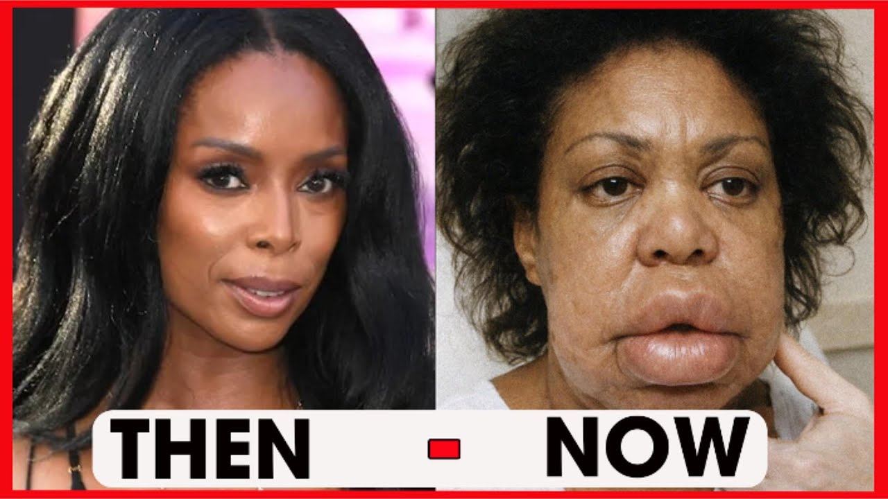13 Black Actors Who Look Horrible With Plastic Surgery | Then and Now 2026