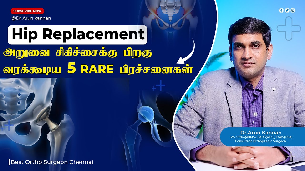 Top 5 but rare Complications after total Hip Replacement Surgery | Dr. Arun Kannan