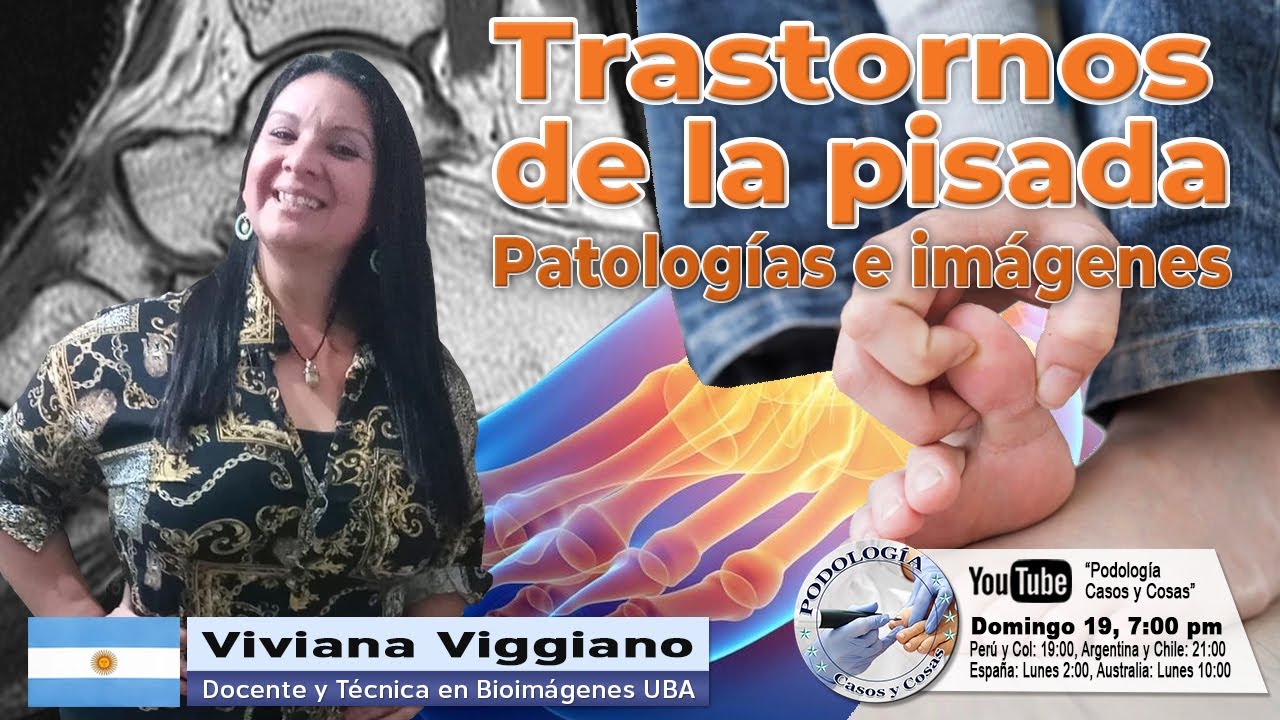 TRASTORNOS DE LA PISADA: PATOLOGÍAS E IMÁGENES | Viviana Viggiano | Podología Casos y Cosas