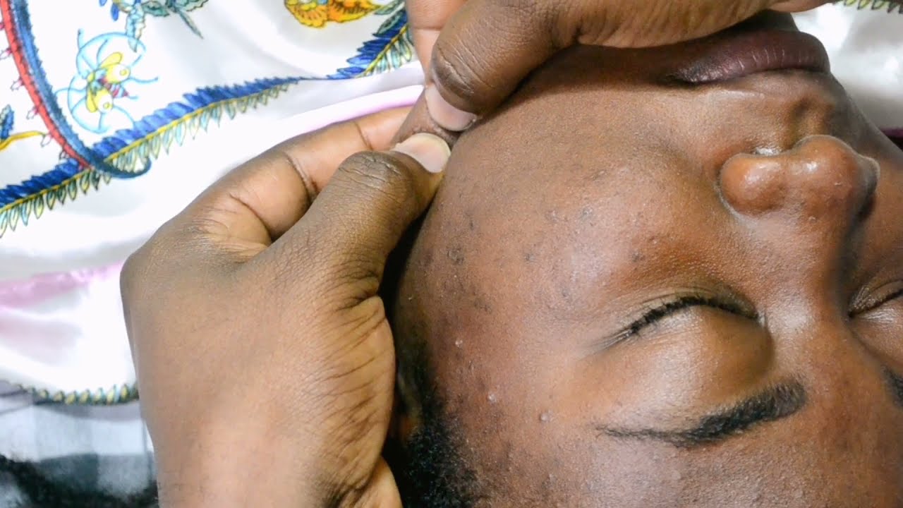 ASMR Nitpicking Whiteheads On Face &bull; Face checkup || PAMPERING