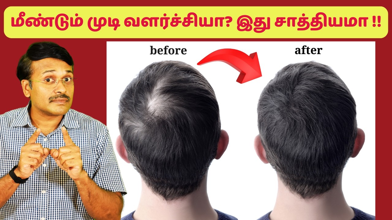 மீண்டும் முடி வளர்ச்சி இந்த 3 முறைகள் மூலம் நடக்குமா ? hair loss treatment
