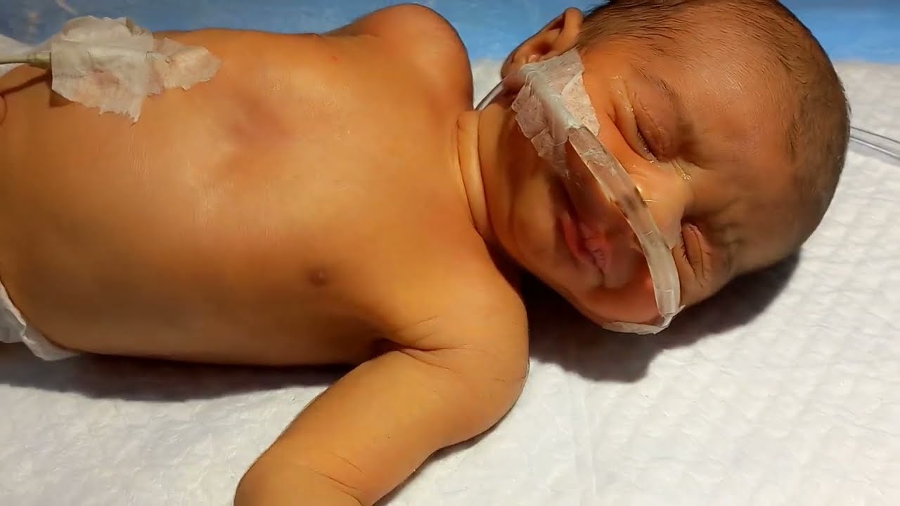 Preterm Pretermbaby male baby 👶 cute preterm baby our nicu wt 2.2kg baby is so beautiful