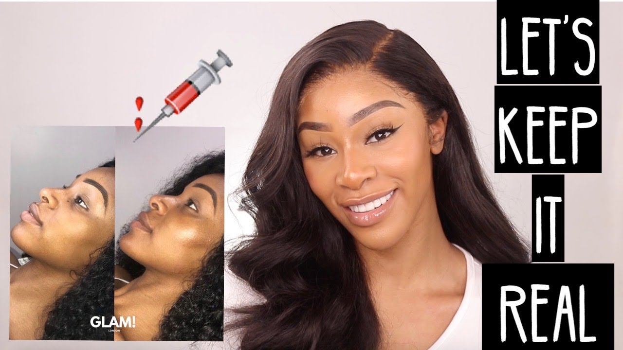 CCGRW - HIGHLY REQUESTED - FILLERS, REGRETS, WHAT I'VE HAD DONE, PROS & CONS FT BEAUTY FOREVER HAIR