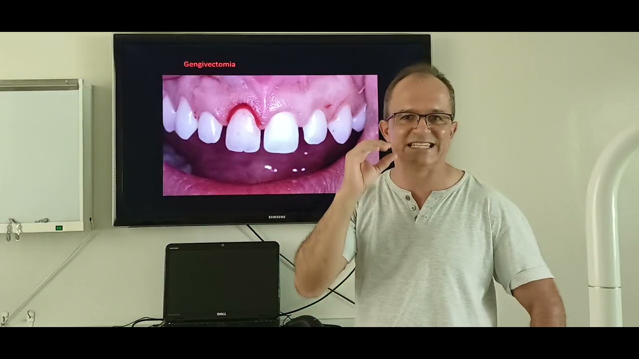 Cirurgia aumento de coroa clínico estético