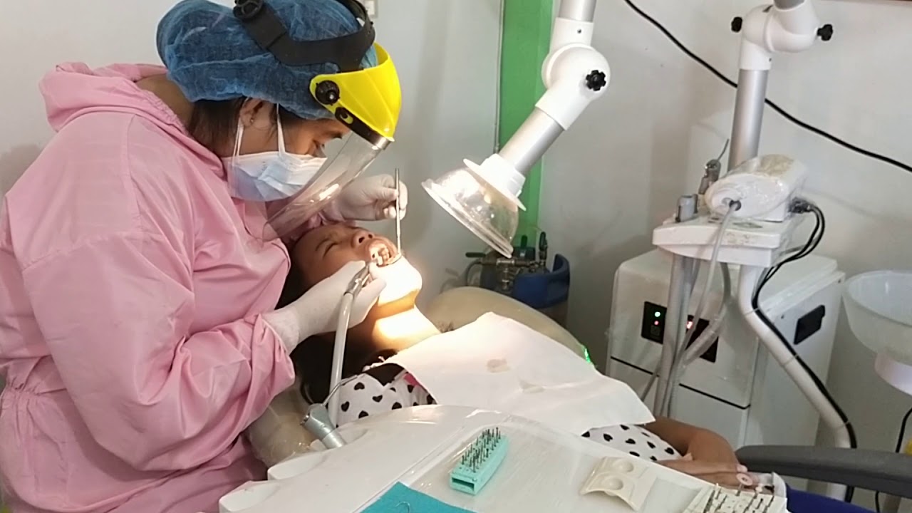 root canal second session