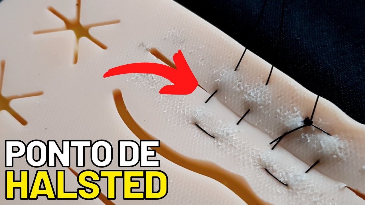 Como fazer um PONTO de HALSTED? Sutura fio Nylon PASSO A PASSO PONTO