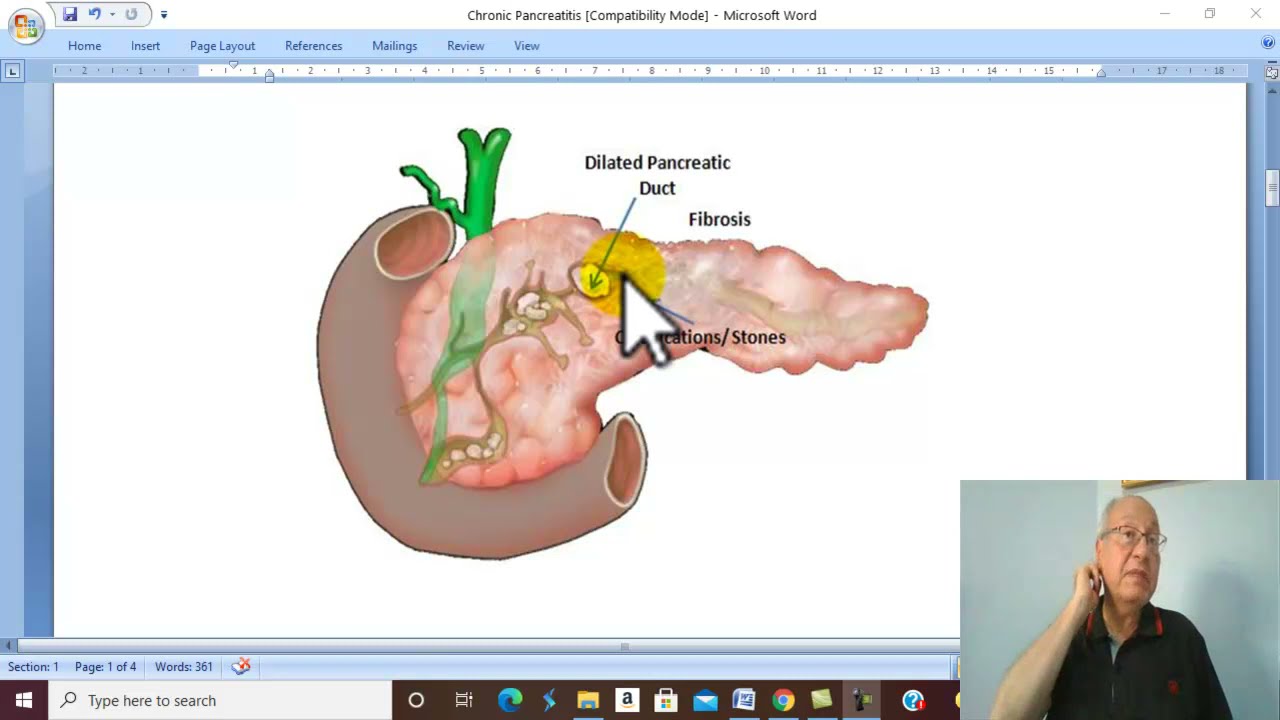 Pancreatic Disorders in Arabic 4 ( Cronic Pancreatitis ) , by Dr. Wahdan