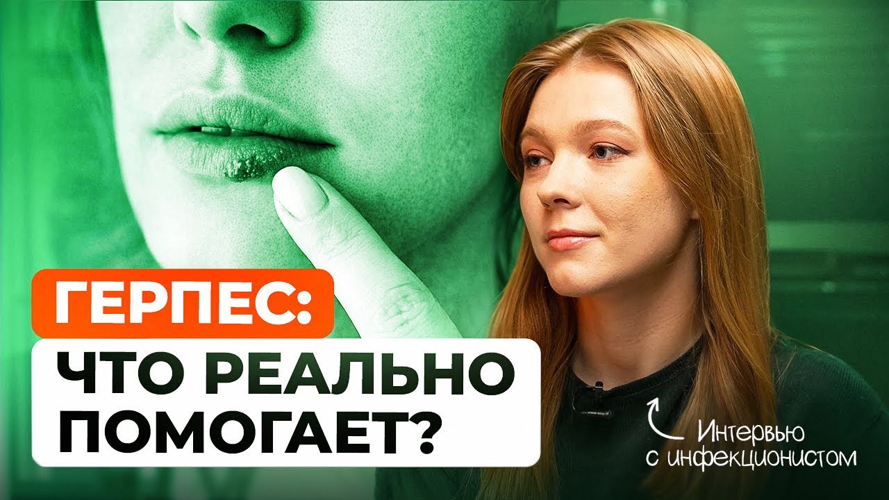 Герпес: как передается, чем лечить простуду на губах и как жить с инфекцией