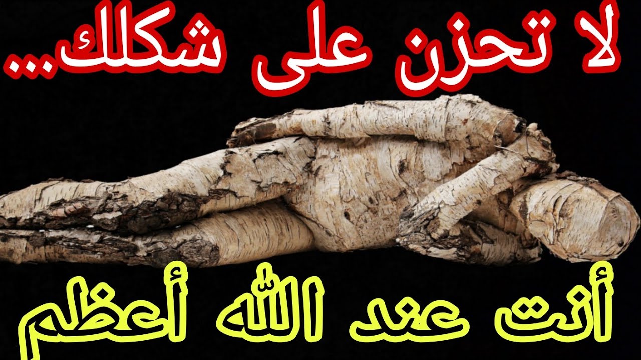 لا تحزن على شكلك...