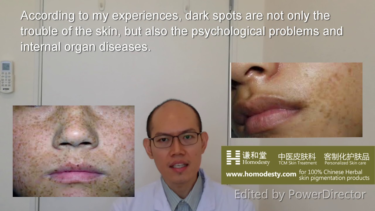 Lesson 4 : The POWERFUL WAYS to permanently make&nbsp;skin pigmentation,&nbsp;Melasma, Freckles dissapear