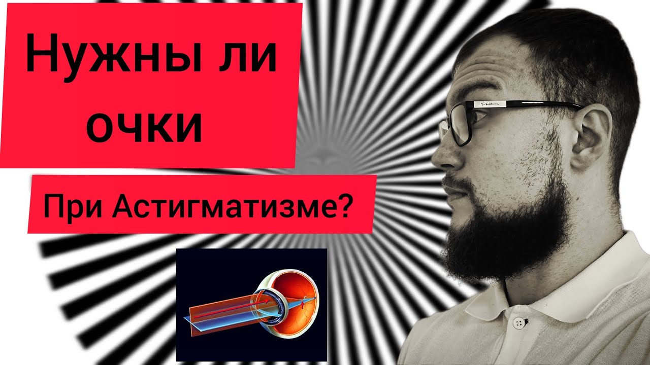 Астигматизм - нужно ли его учитывать в оптической коррекции?