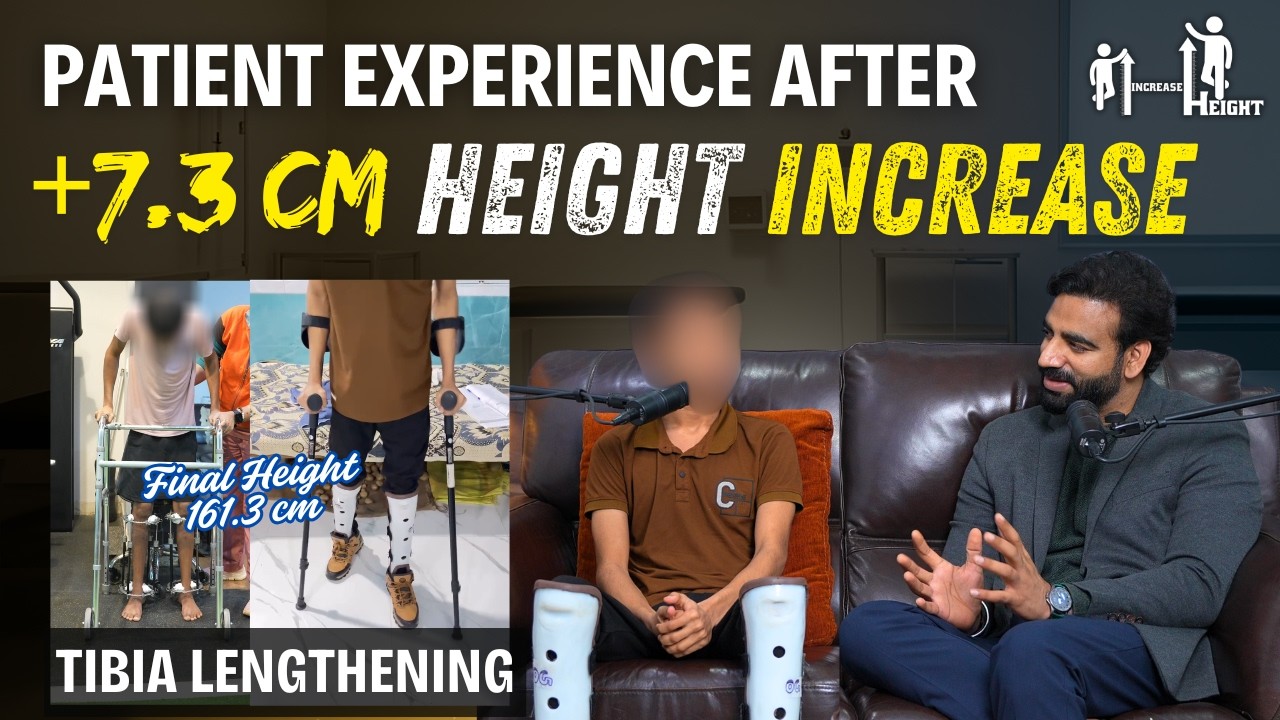 Опыт пациентов после увеличения роста на +7,3 см | Операция по удлинению большеберцовой кости в И...