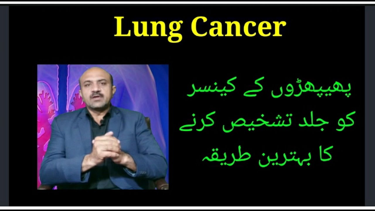 How to Early Diagnose Lung Cancer.SUMMIT study(From UK) reveals.