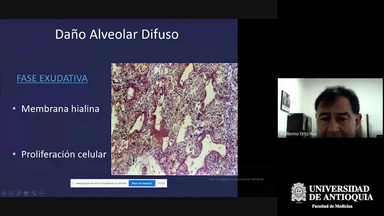 Fenotipos en SDRA - Dr. Guillermo Ortiz