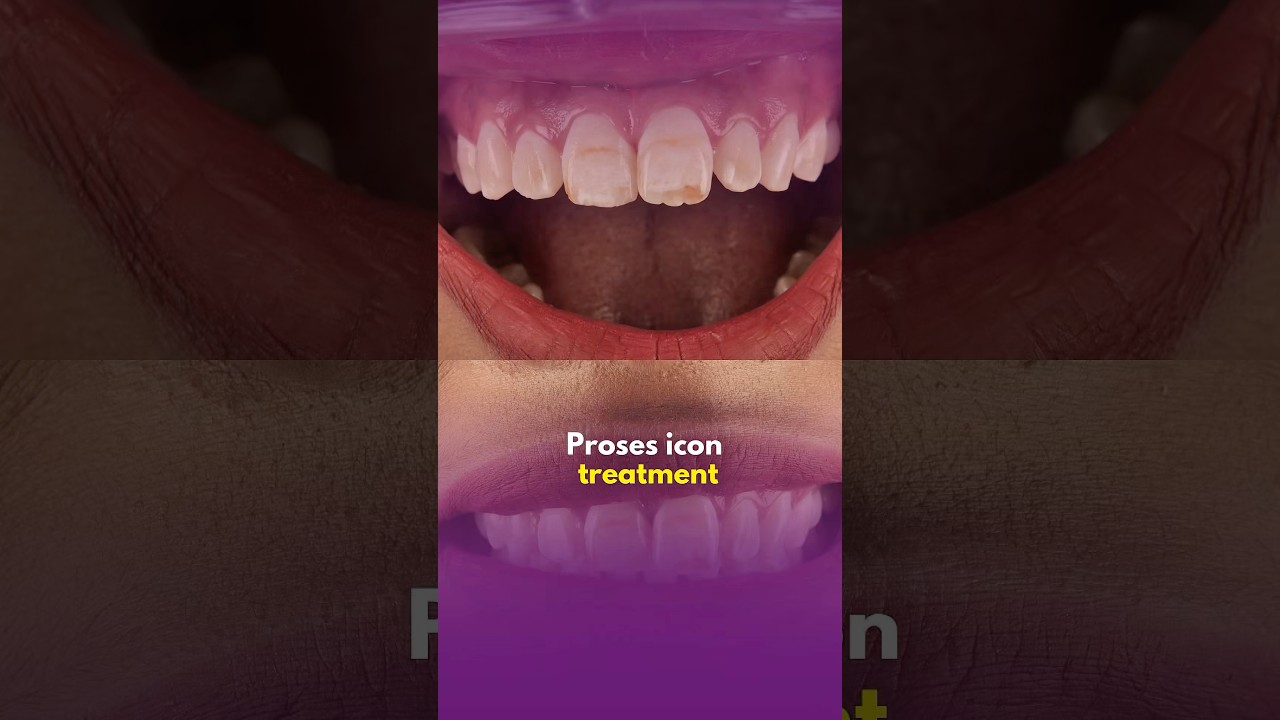 Icon treatment: Proses icon treatment 