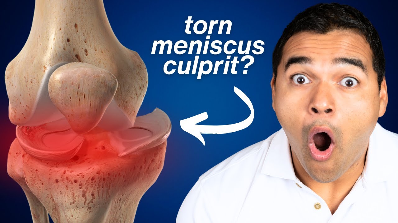 Why Fixing Knee Alignment is Crucial for a Torn Meniscus